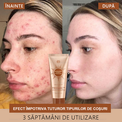 💟FRISSARC™ mască facială pentru albire și îndepărtarea petelor –🍀Ingredientele naturale ajută la eliminarea eficientă și de durată a petelor pigmentare, petelor de vârstă, pistruilor, coșurilor și urmelor de acnee 🔥🔥🔥