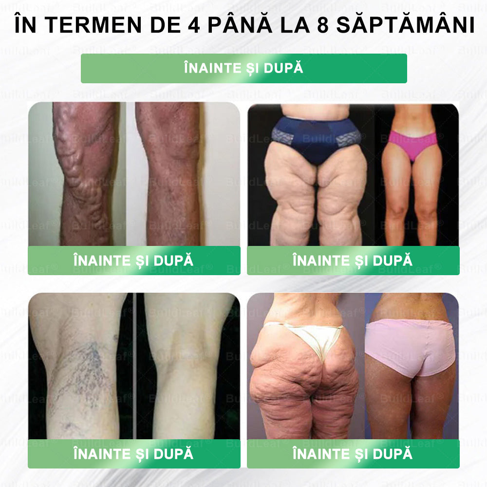 🌿𝑩𝒖𝒊𝒍𝒅𝑳𝒆𝒂𝒇® GLP-1 8-în-1 Fit & Vital Soluție orală – ⏰ O dată pe zi, schimbări vizibile în 7 zile / Pentru obezitate, sănătatea inimii și a sistemului cardiovascular, diabet, apnee de somn, sănătatea intestinelor, probleme articulare și multe altele.🍀